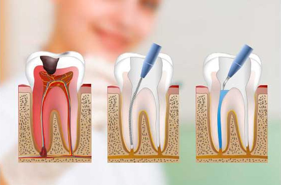 dientes2